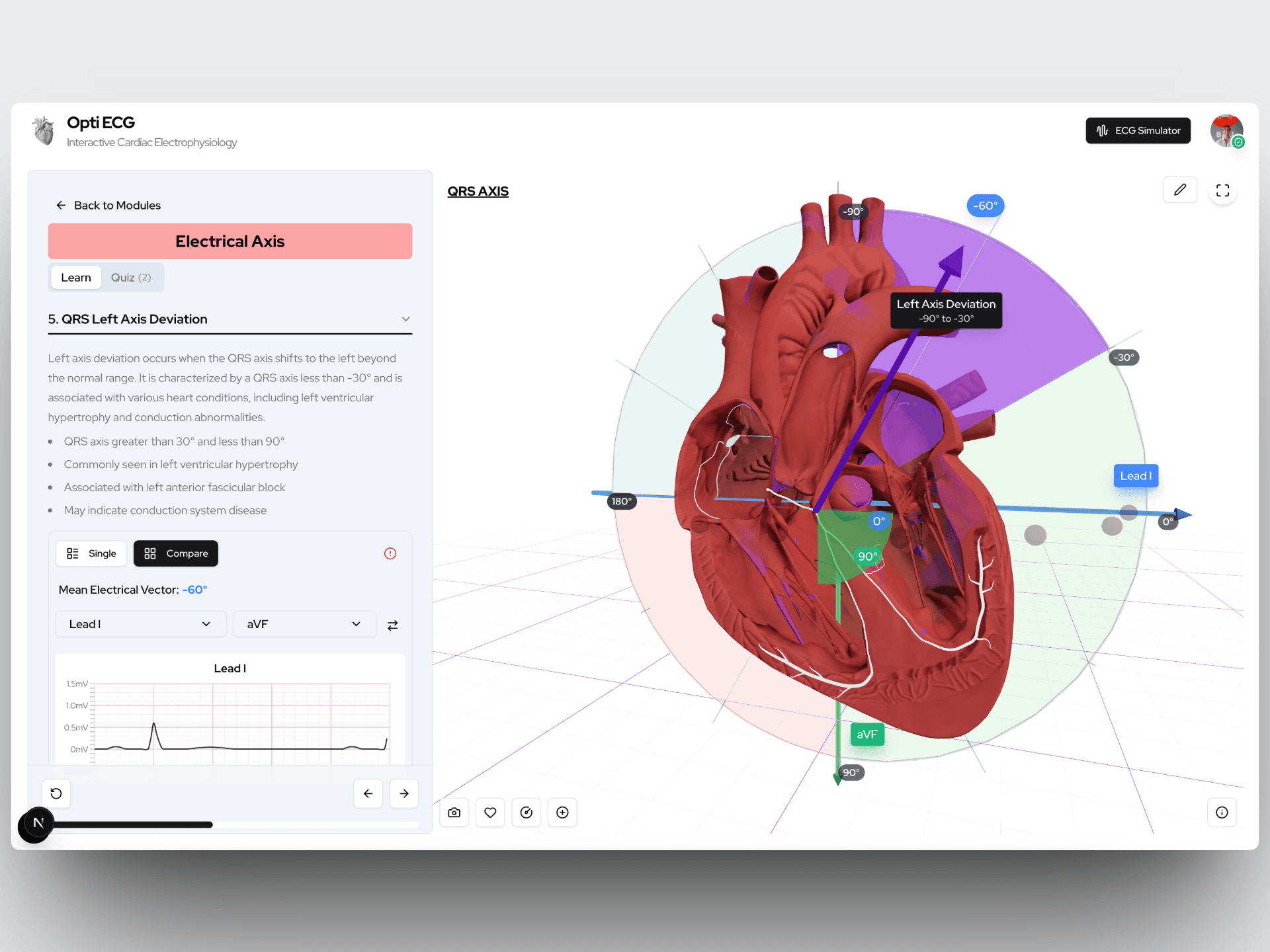 Opti ECG interactive cardiac axis visualization with 3D heart model