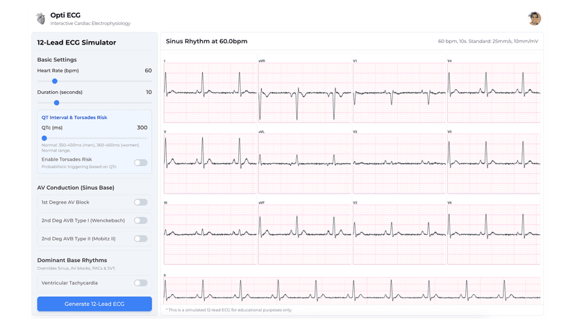 Opti ECG - Interactive 3D Cardiac Electrophysiology Learning Platform
