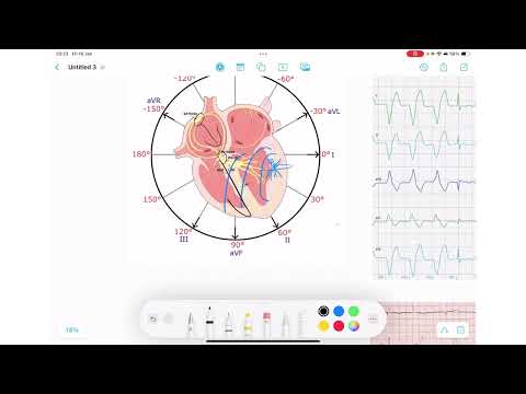 ECG Rhythm Series | AIVR