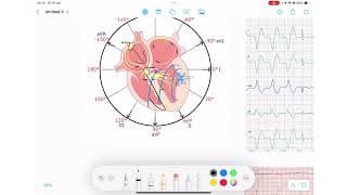 ECG Rhythm Series | AIVR