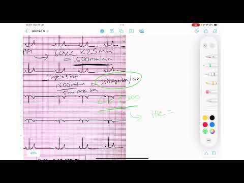 ECG Basics Series | Measurements
