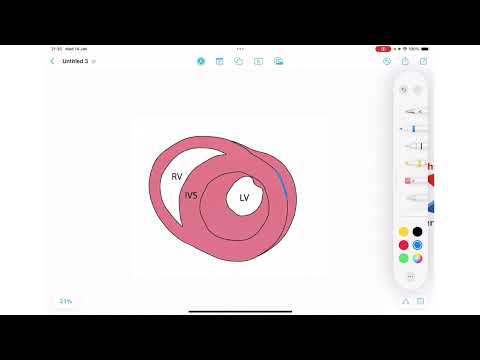 ECG Rhythm Series | Sinus Rhythm