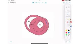 ECG Rhythm Series | Sinus Rhythm