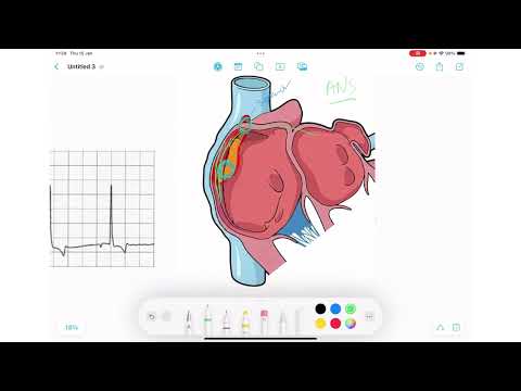 ECG Rhythm Series | Wandering Pacemaker