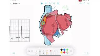 ECG Rhythm Series | Wandering Pacemaker
