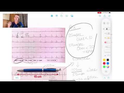 ECG Basics Series | Systematic Approach to ECG Interpretation