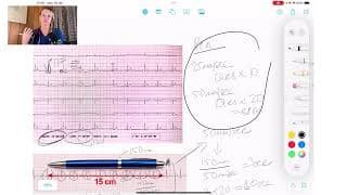 ECG Basics Series | Systematic Approach to ECG Interpretation